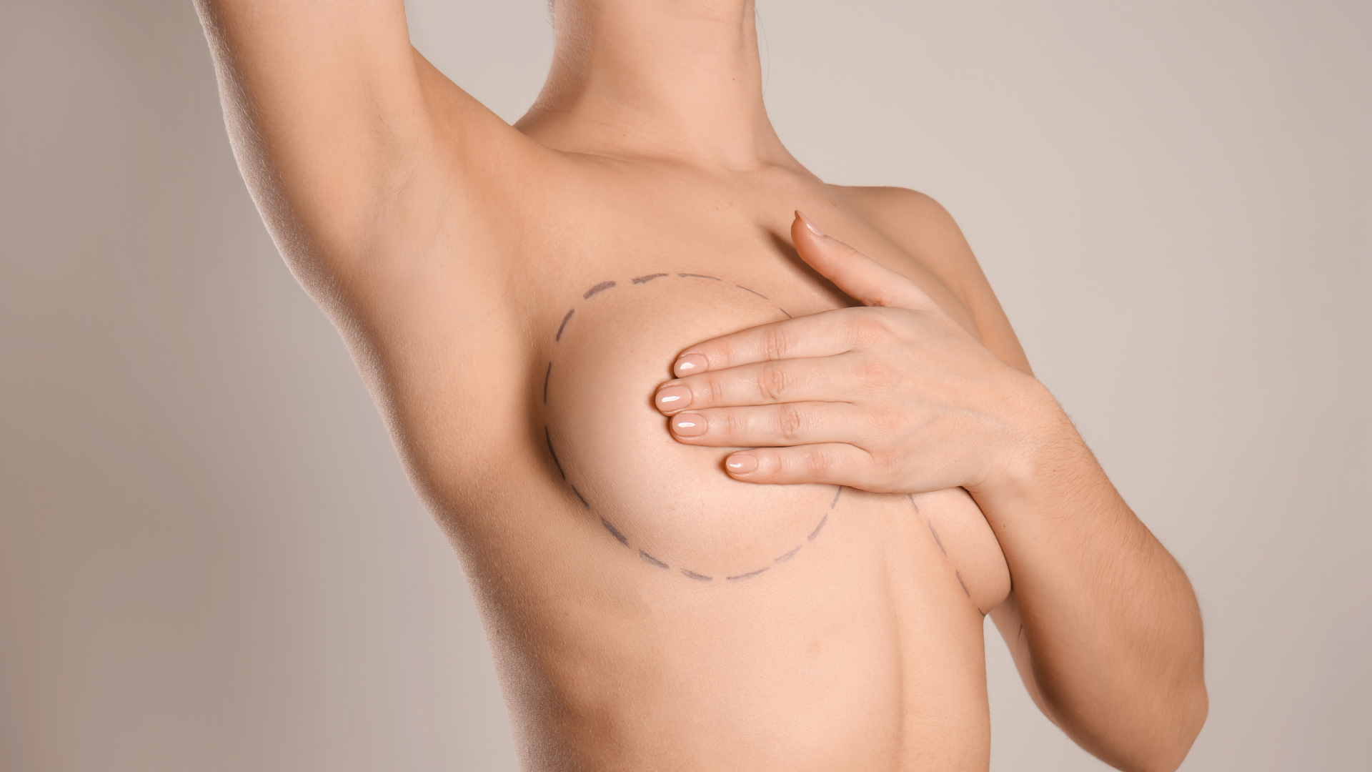 Cirurgia de mama — prótese de silicone e mastopexia